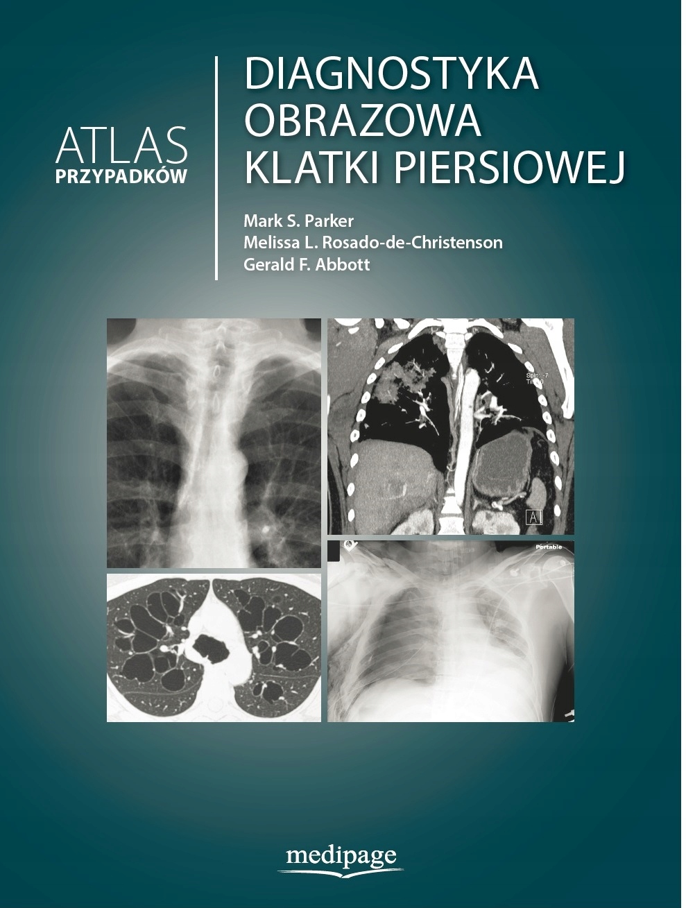 Diagnostyka Obrazowa Klatki Piersiowej Atlas Z Allegro Pl