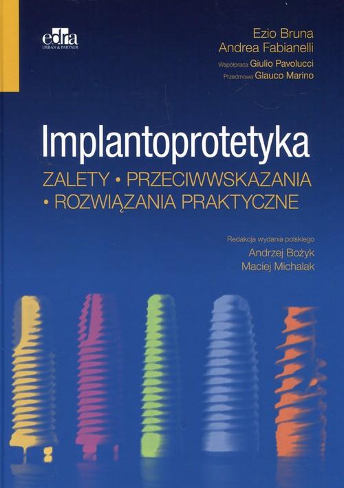 

Implantoprotetyka Zalety przeciwwskazania rozwiąza