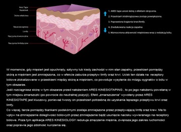 ЭКСТРЕМАЛЬНЫЙ КИНЕЗИОТЕЙПИРОВАНИЕ ARES KINESIOLOGY