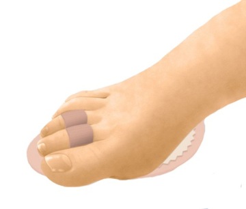 Сломанный КОРРЕКЦИОНЕР HAMMER TOE PAD