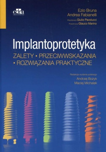 Implantoprotetyka Zalety przeciwwskazania